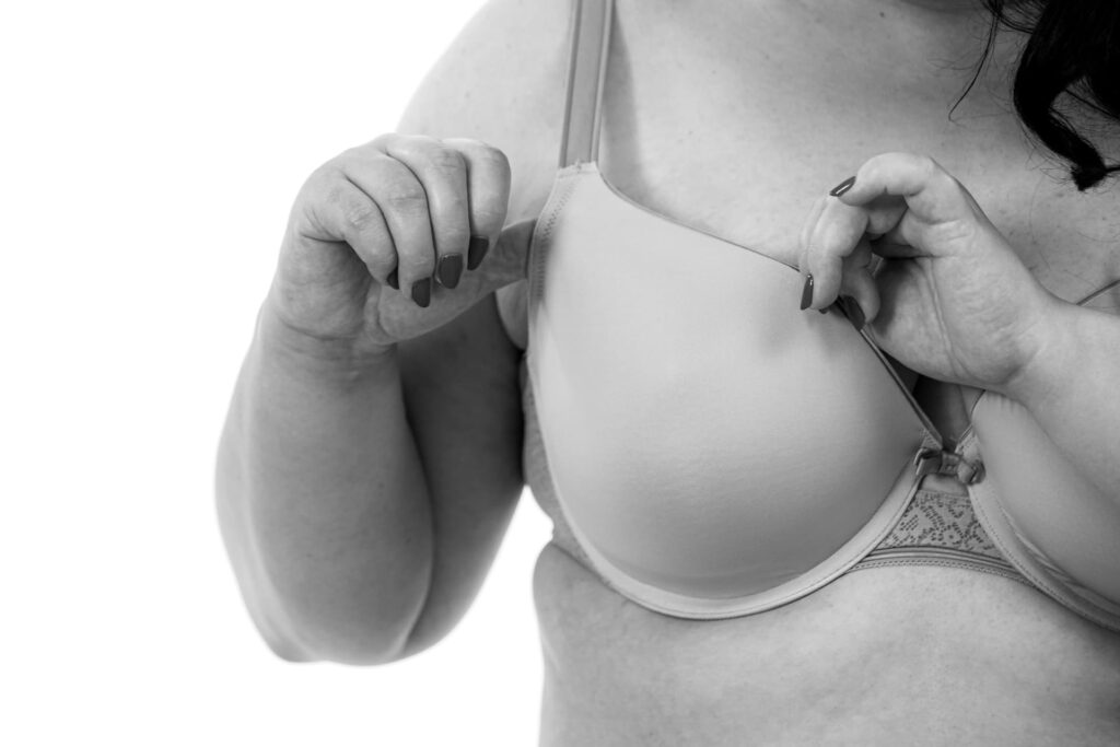 Une femme ronde réajustant son soutien-gorge de taille importante évoquant une hypertrophie mammaire