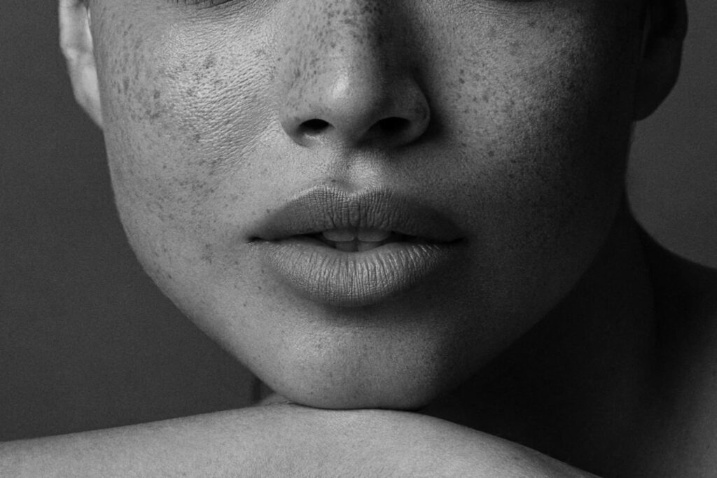 Gros plan de face sur les lèvres d'une femme illustrant les résultats esthétique d'un lifting de lèvre proposé par le Dr Ruiz à Nantes