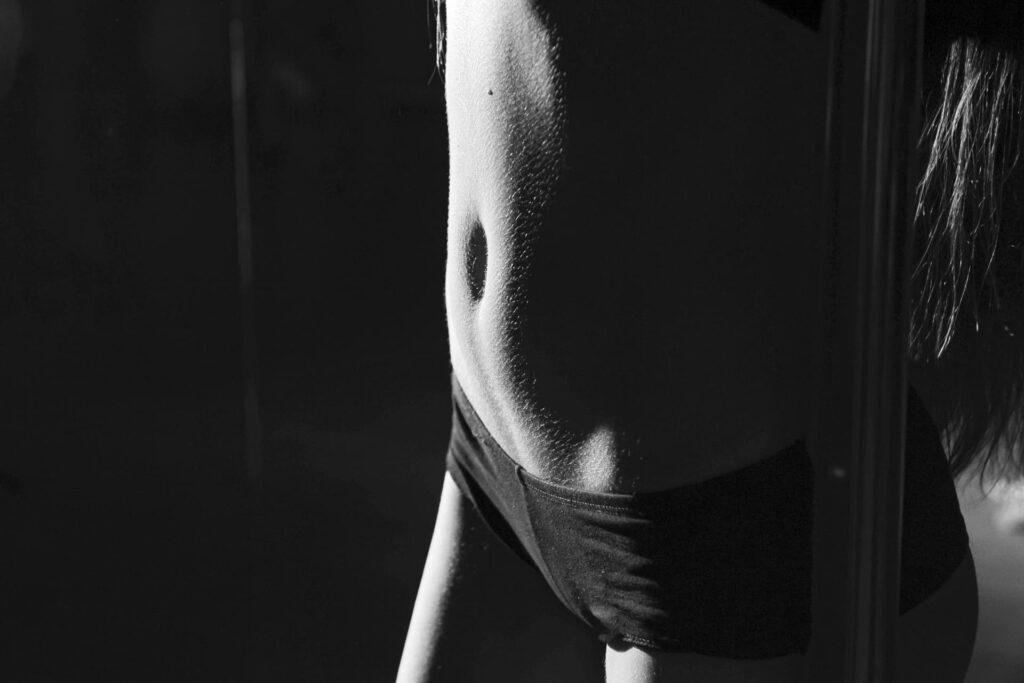 Ventre plat d'une femme illustrant les résultats d'une plastie abdominale